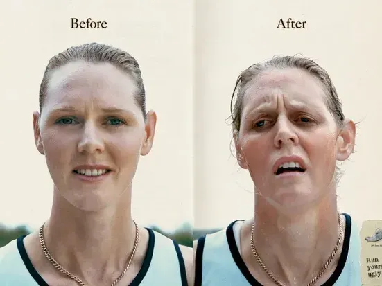 Runner Face : qu'est-ce que c'est et comment l'éviter ?